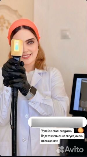 Лазерная эпиляция