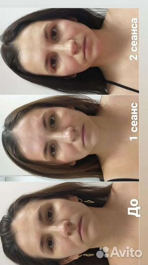 Миофасциальный + скульптурный массаж лица