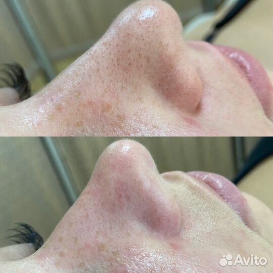 Услуги косметолога