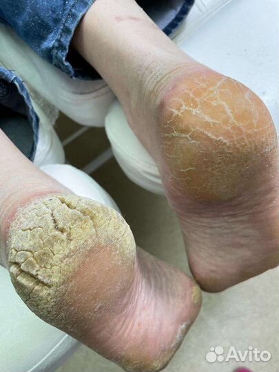 Педикюр/Подология