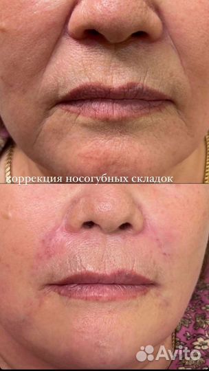 Услуги косметолога