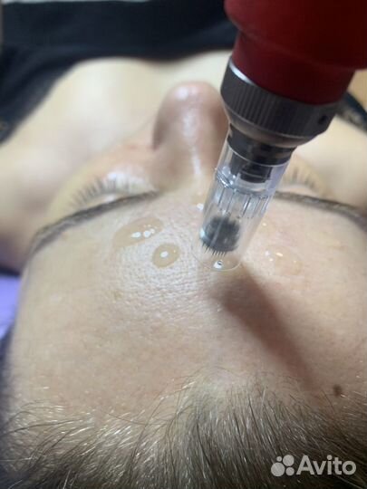 Hydrafacial,фракционая меза лица,тела,головы,рук