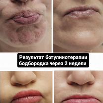 Услуги косметолога, Люберцы