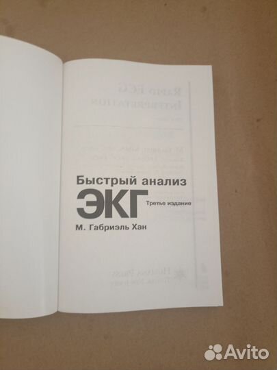 Быстрый анализ экг