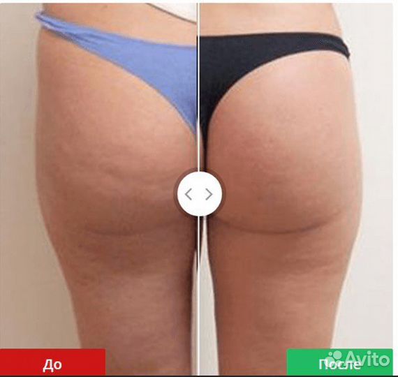 Аппаратный массаж Vela Shape