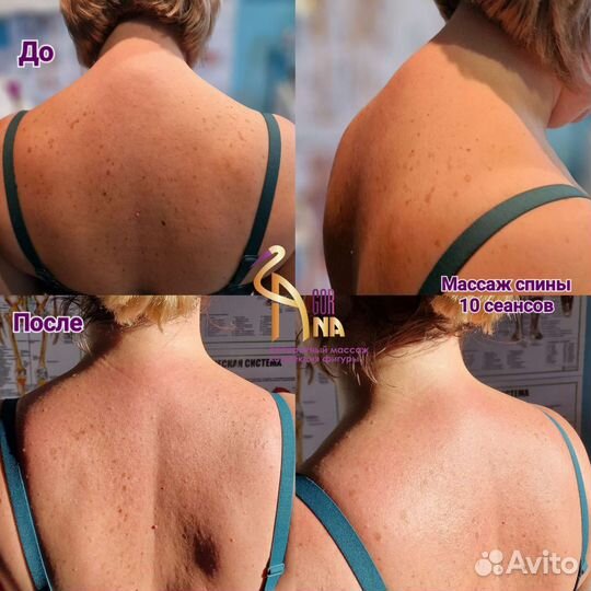 Массаж спины и шейно-воротниковой зоны