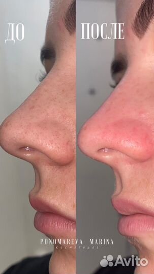 Услуги косметолога