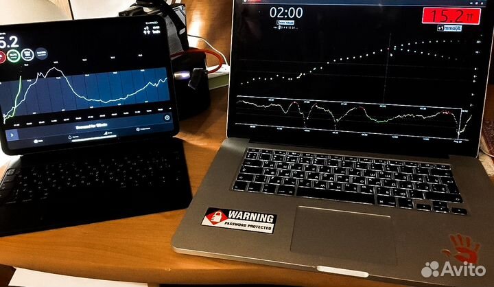 Настройка мониторинга сахара (xDrip + Nightscout)