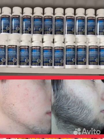 Миноксидил для роста бороды и волос