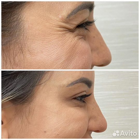 Услуги косметолога