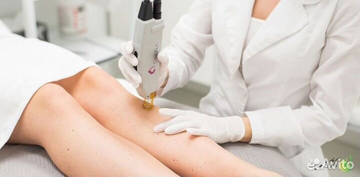 Франшиза лазерной эпиляции в топовых локациях