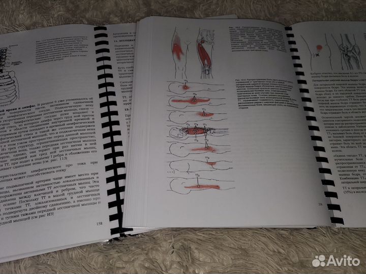 Fascia. Что это такое и почему это важно