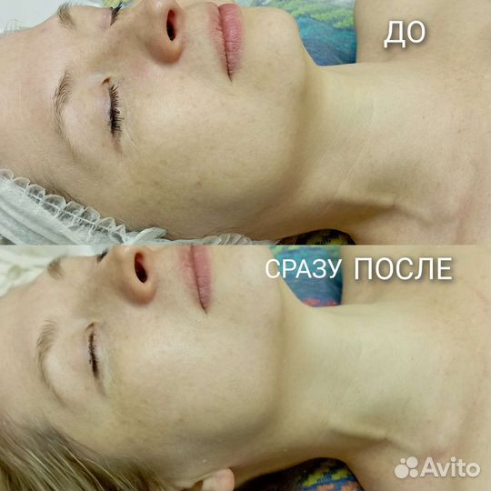 Микротоковая терапия