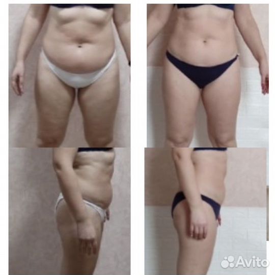 Массажlpg,прессотерапия,медовый,спа