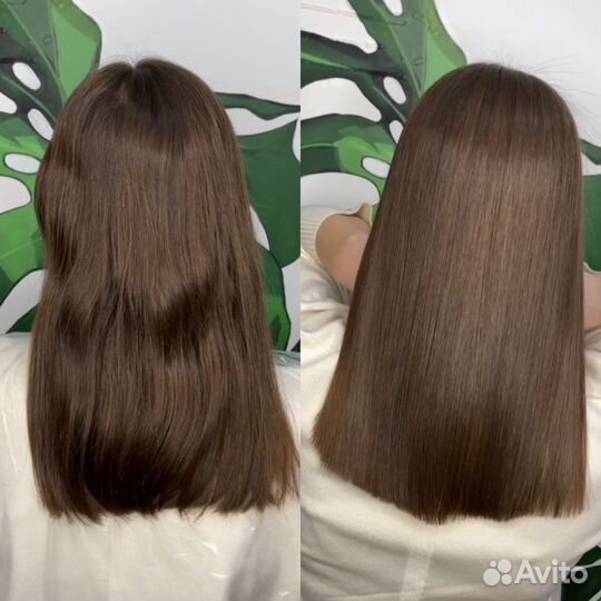 Ботокс, биксипластия,пилинг кожи. Провожу обучение