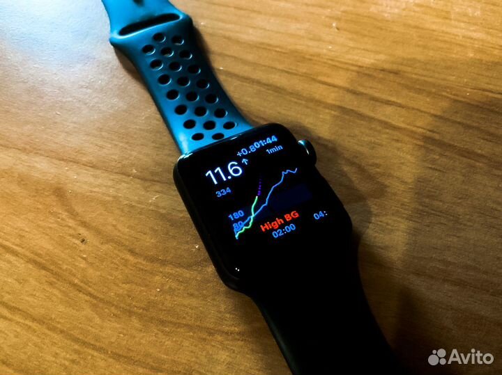 Настройка мониторинга сахара (xDrip + Nightscout)