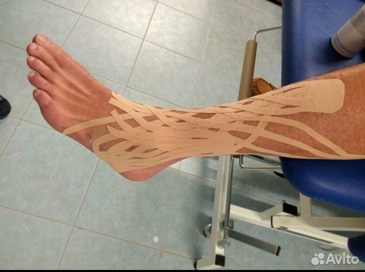 Коррекция фигуры,эстетическое кинезио тейпирование