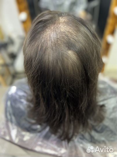 Замещение волос и наращивание ленты Hair Talk