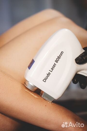 Лазерная эпиляция