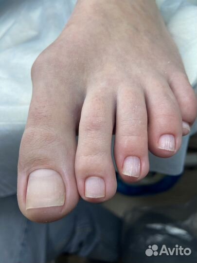 Смарт -педикюр