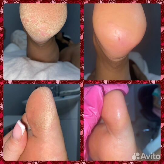 Smart педикюр