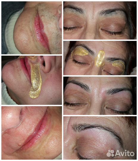 Услуги косметолога