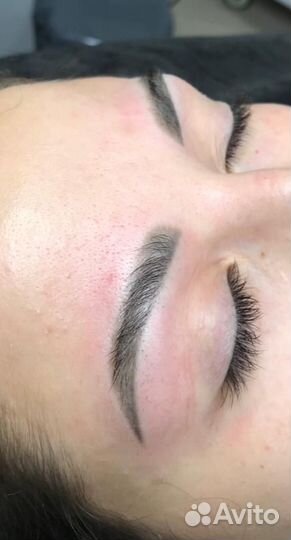 Лазерное удаление пм и татуировок