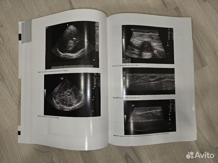 Неврология Национальное руководство Том 1