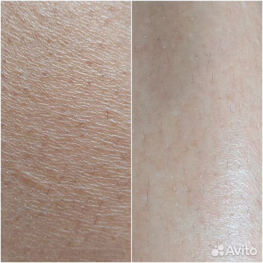 Пилинг Модильяни для лица