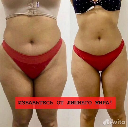 Супер Быстрое Сжигание Жира Криолиполиз 4D