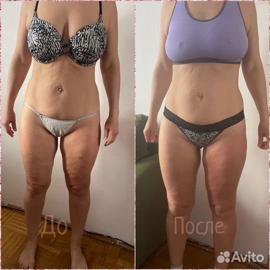 Вакуумно-роликовый массаж starvac