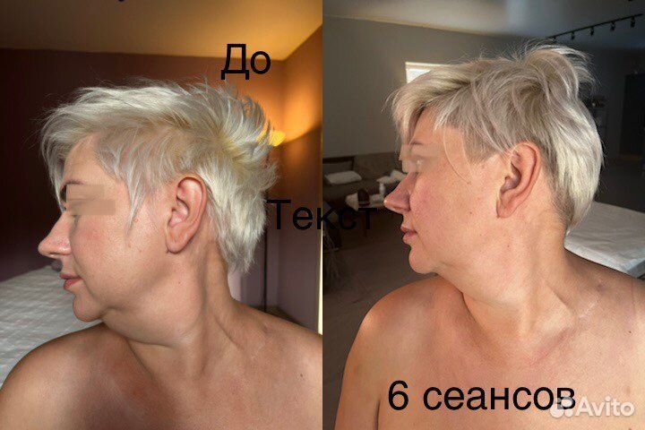 Миофасциальный массаж лица, шеи, головы