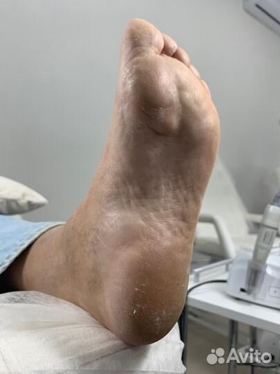 Смарт педикюр