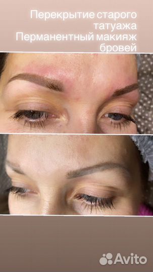 Перманентный татуаж бровей,губ