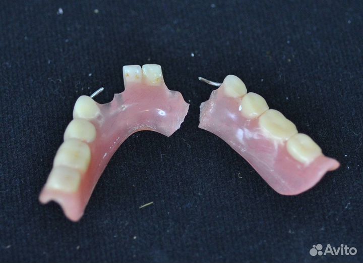 Зубной техник съемное протезирование