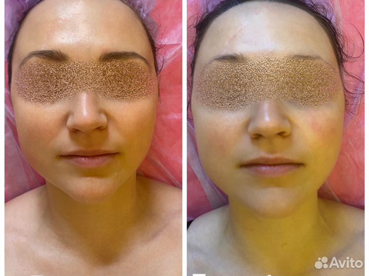 Консультация косметолога