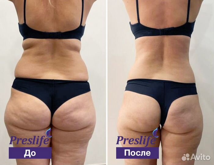 Прощай живот. Комплекс коррекции фигуры