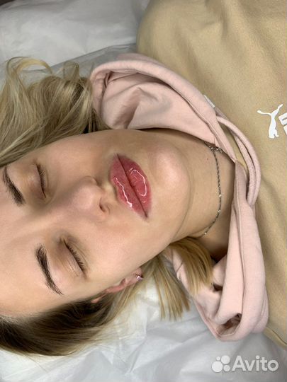 Увеличение губ/кп лица/ботокс обучение