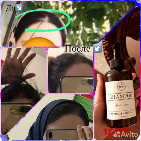 Шампунь против выпадения волос