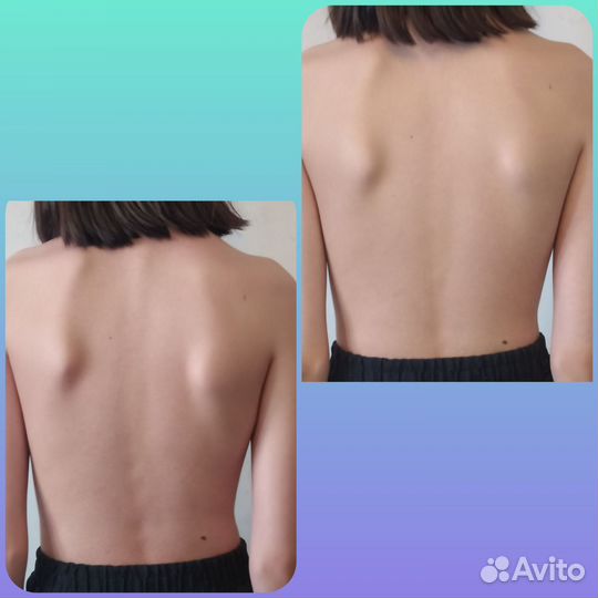 Классический массаж для мужчин и женщин