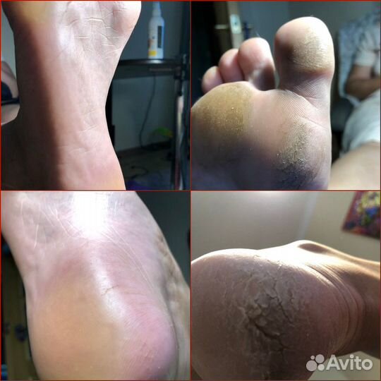 Гель лак,наращивание,коррекция,Аппаратный педикюр