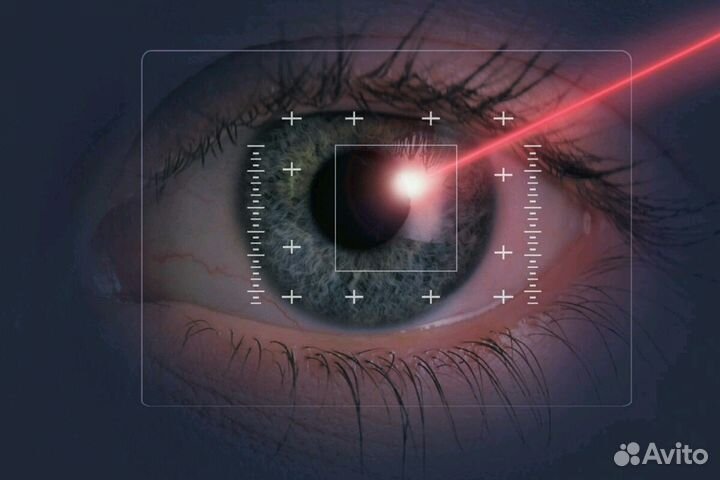 Офтальмолог,зелён. лазер,YAG,рефракционная хирурги