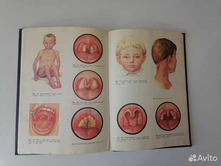 Книга Детские болезни