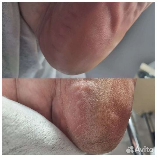 Маникюр, педикюр