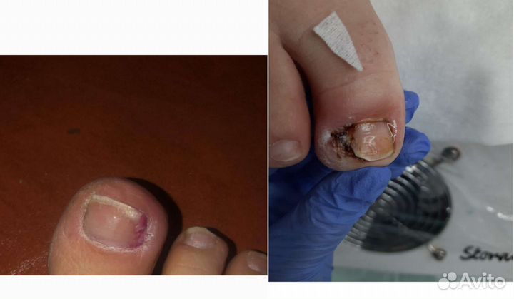 Услуги подолога