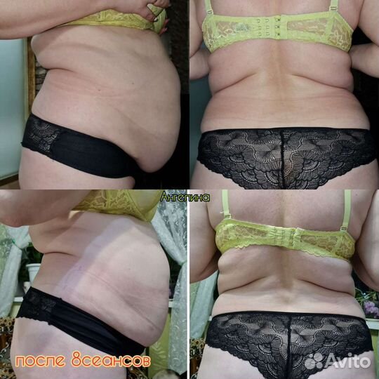 Массаж лица И тела