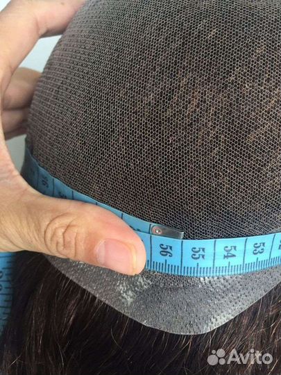 Система замещения волос