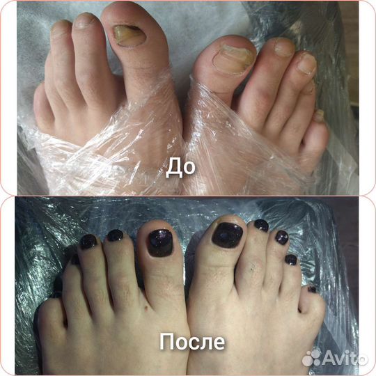 Маникюр педикюр