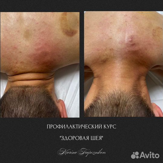 Оздоровительный массаж