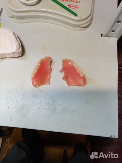 Ремонт съёмных зубных протезов